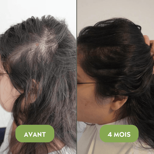 🧴⭐ Huile naturelle pour la croissance des cheveux